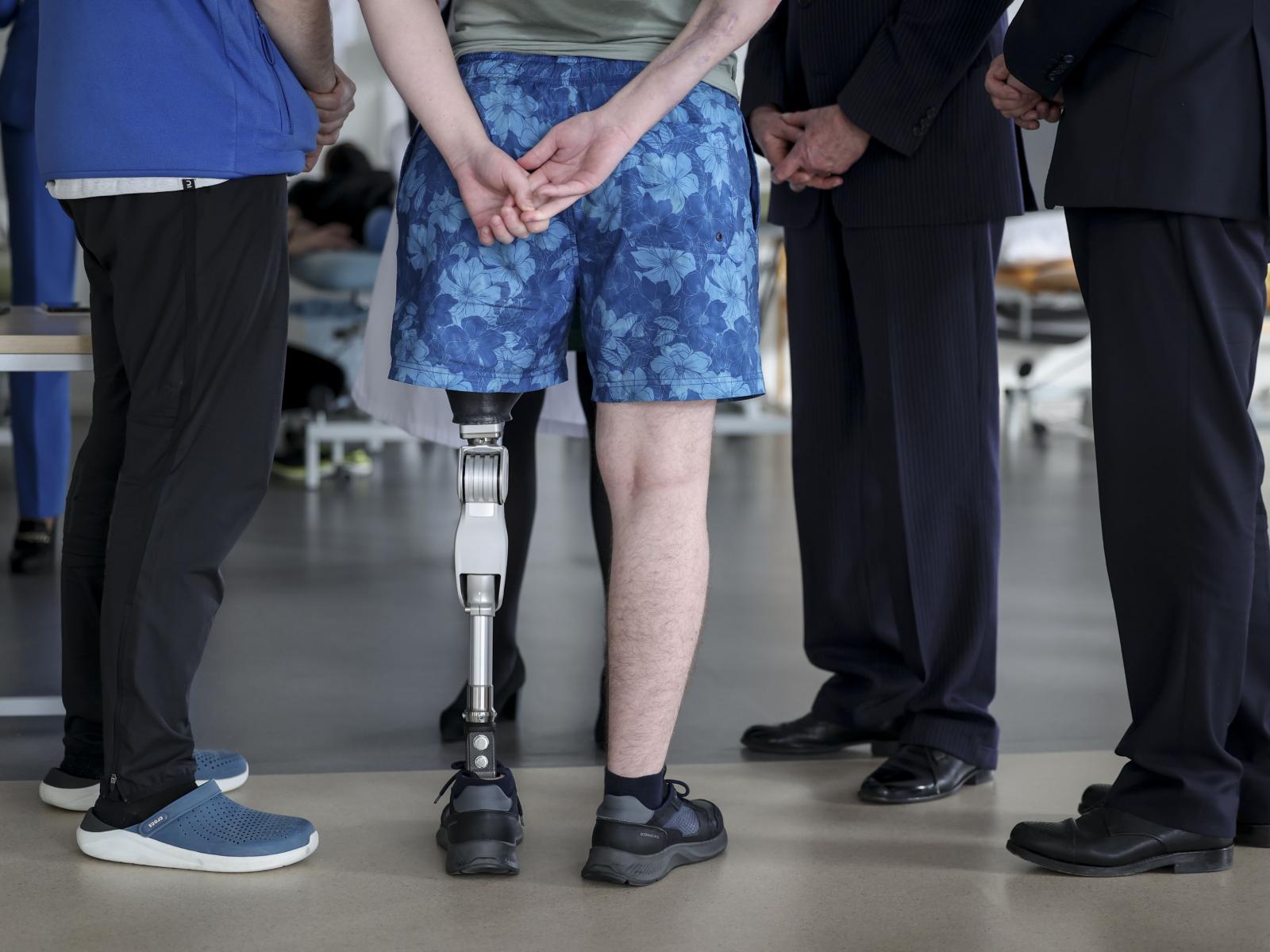Vue sur un patient avec une prothèse de jambe